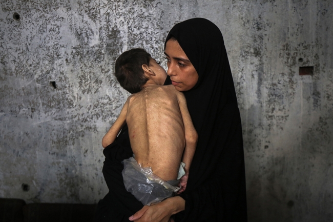 غزة.. خطر الموت الجماعي يهدد أكثر من 100 ألف طفل بسبب الحصار