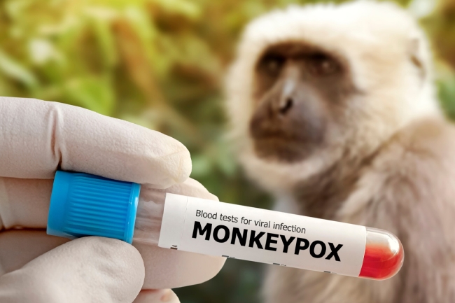 «الصحة العالمية»: جُدري القردة لم يعد حالة طوارئ صحية دولية